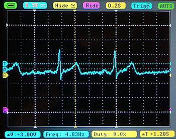 Heart Waveform Measurements