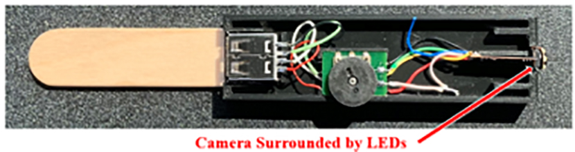 Development of a Novel Telemedical Device: the PharynxScope