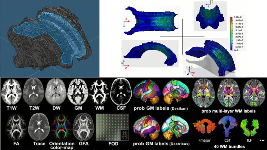 Living Brain Project slide 2