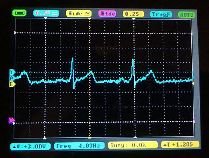 ECG measurement