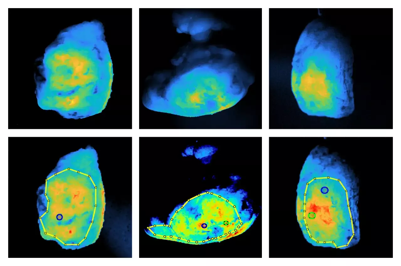 Ken Tichauer cancer detection